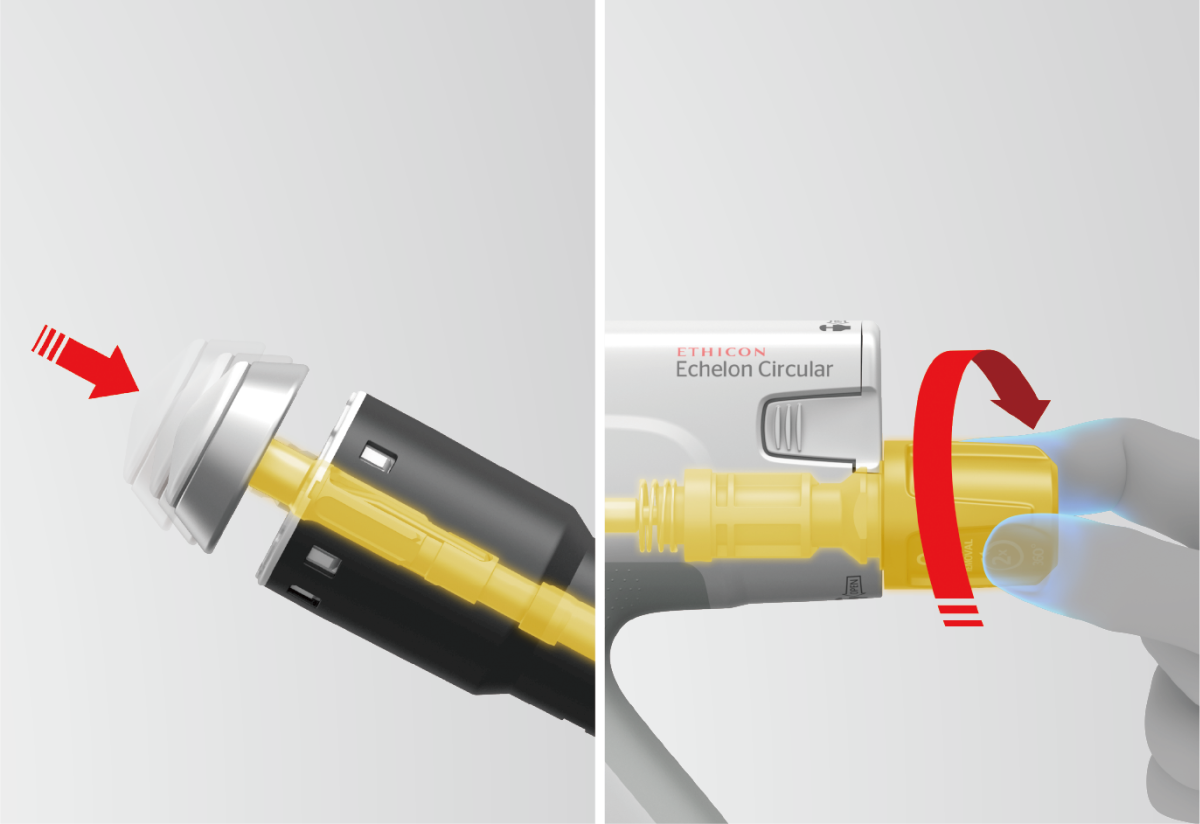 その他 coron ECHELON CIRCULAR Powered Stapler | ESS Website